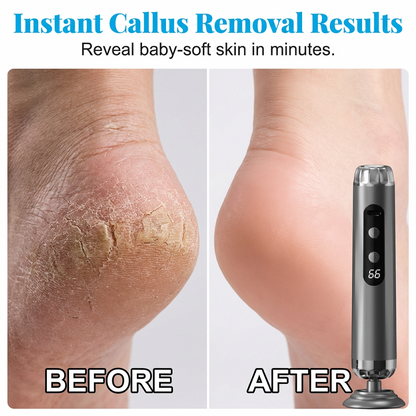 🥳27,000 RPM Electric Foot Renewal – 5 speeds, disposable pads. No scrubbing, salon smooth at home. 🦶✨